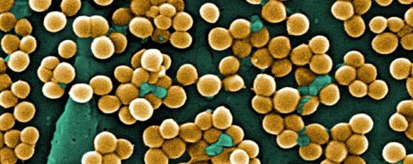 MRSA (Staphylococcus aureus) pod mikroskopem