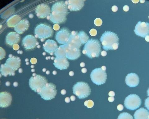 biofilm v ráně