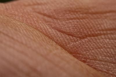 Bőrtünetek - A cukorbetegség első jelei lehetnek