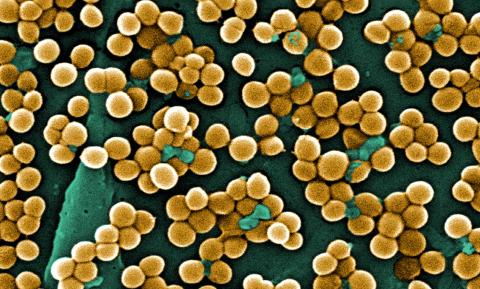 MRSA (Staphylococcus aureus) pod mikroskopem