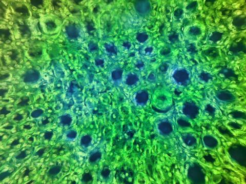 Hypergranulace